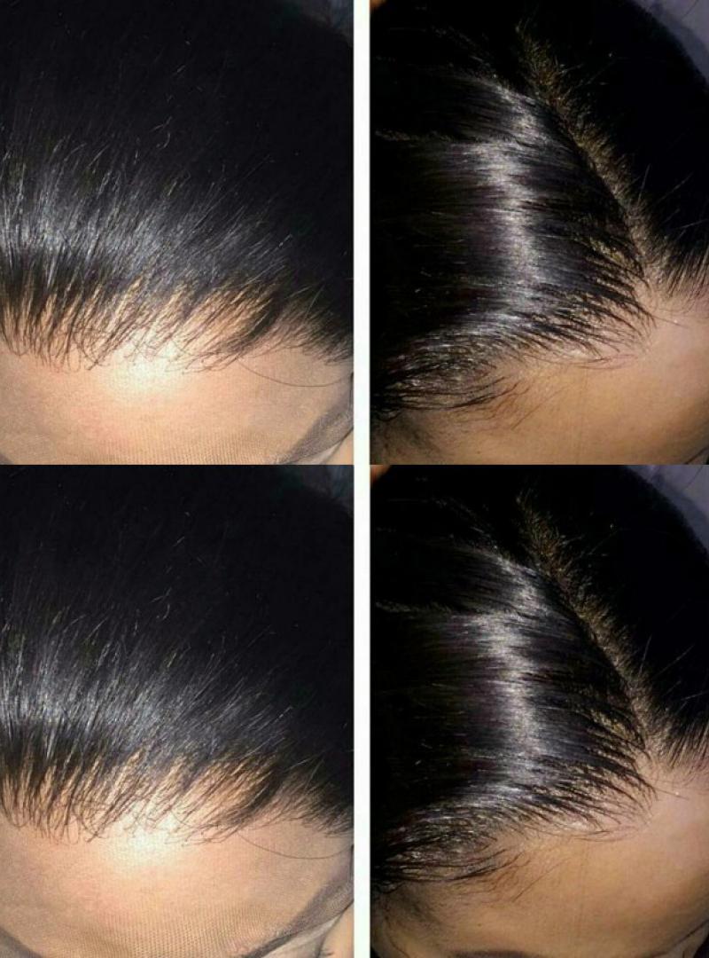 SUPER FINE HD INVISIBLE UNDETECTABLE